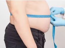 Obesidad